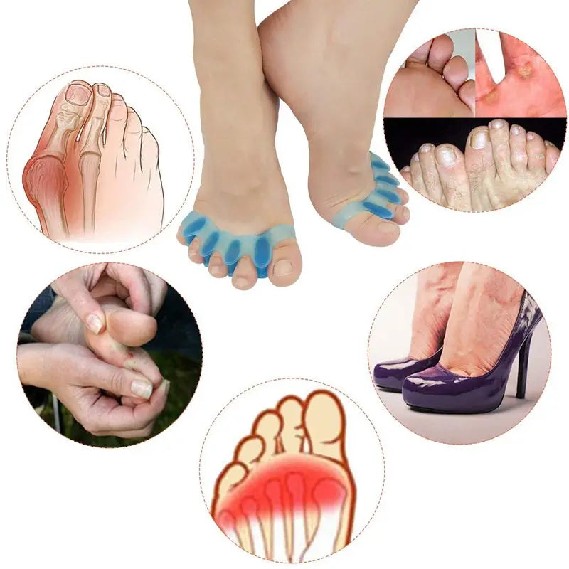 Protettivo Dita Dei Piedi Separatore Adatto Borsite Correttore Materiale Morbido Gel Raddrizzatore Distanziatori Barelle Strumento di Cura